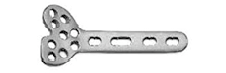 Дистальна променева блокуюча пластина по долонній поверхні UMP